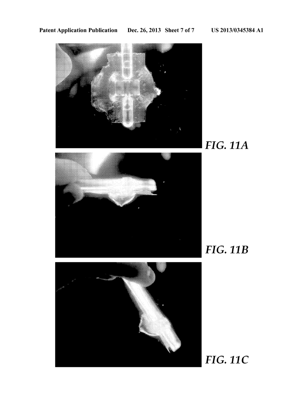 ULTRASONIC-ASSISTED MOLDING OF PRECISELY-SHAPED ARTICLES AND METHODS - diagram, schematic, and image 08