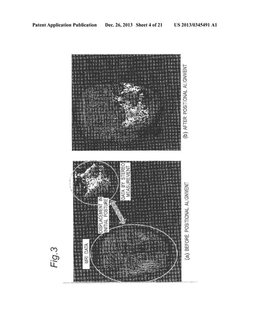 IMAGE DATA PROCESSING DEVICE AND TRANSCRANIAL MAGNETIC STIMULATION     APPARATUS - diagram, schematic, and image 05