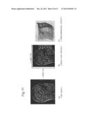 IMAGE DATA PROCESSING DEVICE AND TRANSCRANIAL MAGNETIC STIMULATION     APPARATUS diagram and image