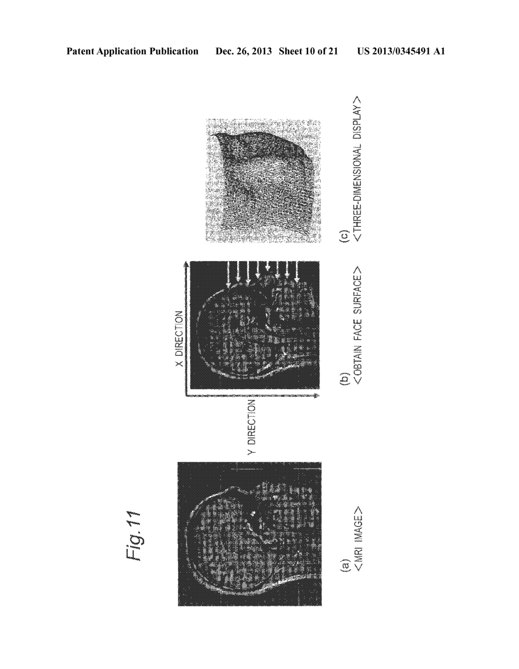 IMAGE DATA PROCESSING DEVICE AND TRANSCRANIAL MAGNETIC STIMULATION     APPARATUS - diagram, schematic, and image 11