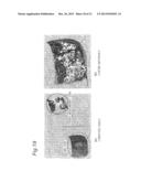 IMAGE DATA PROCESSING DEVICE AND TRANSCRANIAL MAGNETIC STIMULATION     APPARATUS diagram and image