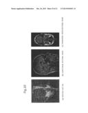 IMAGE DATA PROCESSING DEVICE AND TRANSCRANIAL MAGNETIC STIMULATION     APPARATUS diagram and image