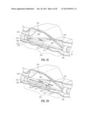 FLOATING, MULTI-LUMEN-CATHETER RETRACTOR SYSTEM FOR A MINIMALLY-INVASIVE,     OPERATIVE GASTROINTESTINAL TREATMENT diagram and image