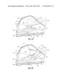 FLOATING, MULTI-LUMEN-CATHETER RETRACTOR SYSTEM FOR A MINIMALLY-INVASIVE,     OPERATIVE GASTROINTESTINAL TREATMENT diagram and image