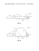 FLOATING, MULTI-LUMEN-CATHETER RETRACTOR SYSTEM FOR A MINIMALLY-INVASIVE,     OPERATIVE GASTROINTESTINAL TREATMENT diagram and image