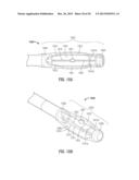 FLOATING, MULTI-LUMEN-CATHETER RETRACTOR SYSTEM FOR A MINIMALLY-INVASIVE,     OPERATIVE GASTROINTESTINAL TREATMENT diagram and image