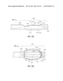 FLOATING, MULTI-LUMEN-CATHETER RETRACTOR SYSTEM FOR A MINIMALLY-INVASIVE,     OPERATIVE GASTROINTESTINAL TREATMENT diagram and image