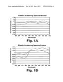 MULTI-EXCITATION DIAGNOSTIC SYSTEM AND METHODS FOR CLASSIFICATION OF     TISSUE diagram and image