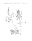 SYSTEMS AND METHODS FOR LOCALIZING AN OPAQUE MEDICAL DEVICE WITH NUCLEAR     MEDICINE IMAGING diagram and image