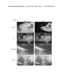 QUANTIFICATION AND ANALYSIS OF ANGIOGRAPHY AND PERFUSION diagram and image