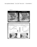 QUANTIFICATION AND ANALYSIS OF ANGIOGRAPHY AND PERFUSION diagram and image