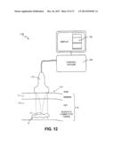 METHODS FOR PREHEATING TISSUE FOR COSMETIC TREATMENT OF THE FACE AND BODY diagram and image