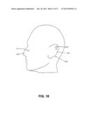 METHODS FOR PREHEATING TISSUE FOR COSMETIC TREATMENT OF THE FACE AND BODY diagram and image