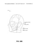 METHODS FOR PREHEATING TISSUE FOR COSMETIC TREATMENT OF THE FACE AND BODY diagram and image