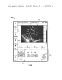 DIAGNOSTIC SYSTEM AND METHOD FOR OBTAINING AN ULTRASOUND IMAGE FRAME diagram and image