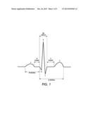 DETERMINING CARDIAC ARRHYTHMIA FROM A VIDEO OF A SUBJECT BEING MONITORED     FOR CARDIAC FUNCTION diagram and image