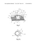 SKULL ENDOSSEOUS MODULE FOR ULTRASOUND PENETRATION diagram and image