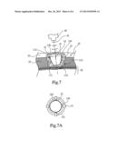 SKULL ENDOSSEOUS MODULE FOR ULTRASOUND PENETRATION diagram and image