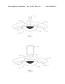 Intracorneal Drug Delivery Device and Associated Methods diagram and image