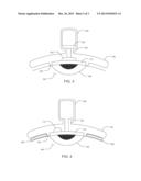 Intracorneal Drug Delivery Device and Associated Methods diagram and image