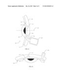 Intracorneal Drug Delivery Device and Associated Methods diagram and image