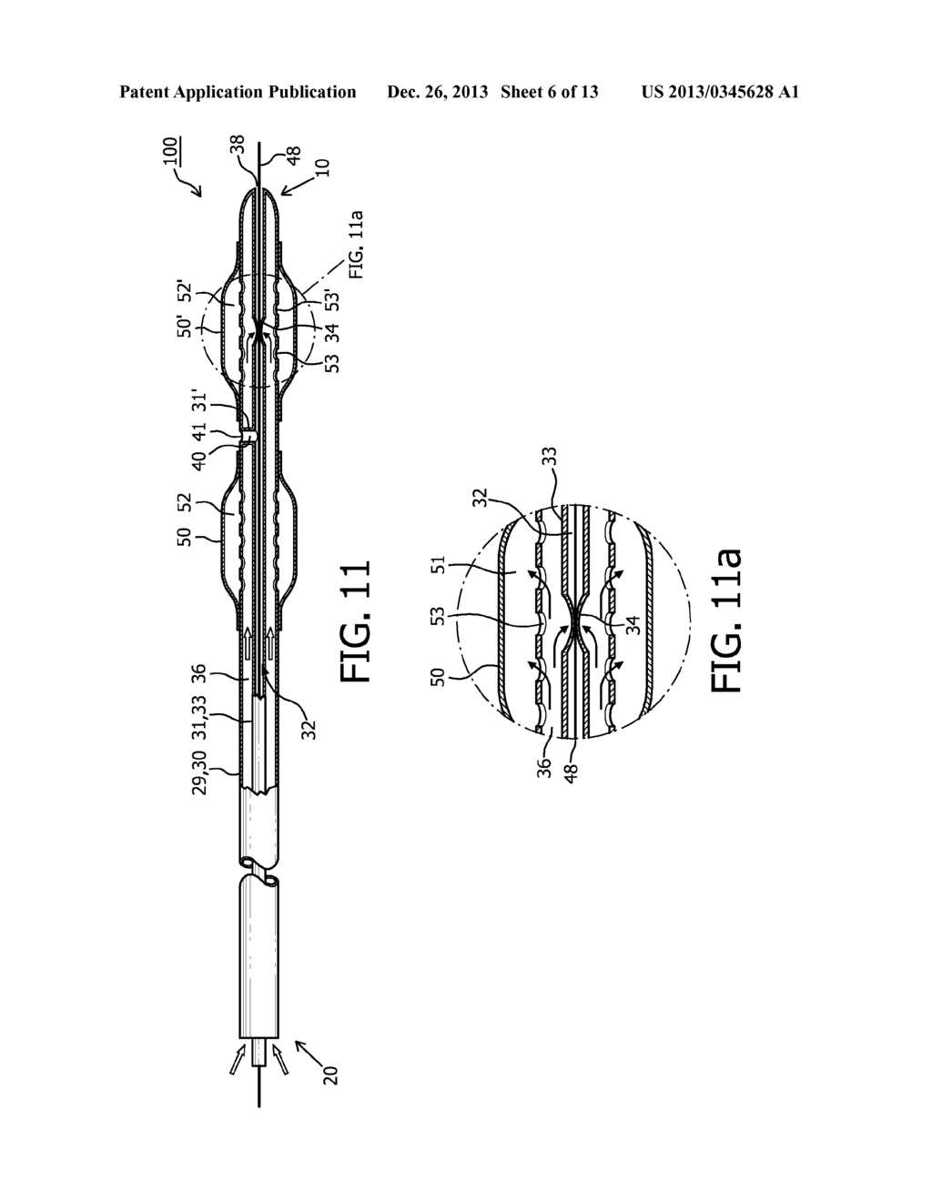 NARROW PROFILE CATHETER WITH DEFORMATION-RESISTIVE GUIDEWIRE LUMEN - diagram, schematic, and image 07