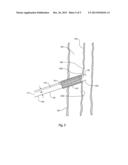 CARRIERS FOR HEMOSTATIC TRACT TREATMENT diagram and image