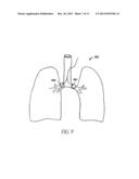 SYSTEM AND METHOD FOR BRONCHIAL DILATION diagram and image