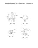 SYSTEM AND METHOD FOR BRONCHIAL DILATION diagram and image