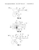 SURGICAL INSTRUMENTS WITH STRUCTURES TO PROVIDE ACCESS FOR CLEANING diagram and image