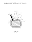 STEERABLE AND CURVABLE CAVITY CREATION SYSTEM diagram and image