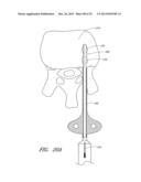 STEERABLE AND CURVABLE CAVITY CREATION SYSTEM diagram and image