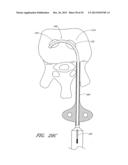 STEERABLE AND CURVABLE CAVITY CREATION SYSTEM diagram and image