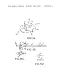 FUSION CAGE WITH COMBINED BIOLOGICAL DELIVERY SYSTEM diagram and image