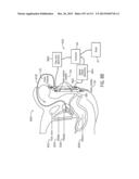 SURGICAL ROBOT PLATFORM diagram and image