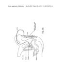 SURGICAL ROBOT PLATFORM diagram and image