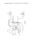 SURGICAL ROBOT PLATFORM diagram and image