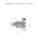 SURGICAL ROBOT PLATFORM diagram and image