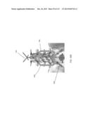 SURGICAL ROBOT PLATFORM diagram and image