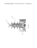 SURGICAL ROBOT PLATFORM diagram and image