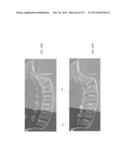 SURGICAL ROBOT PLATFORM diagram and image