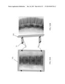 SURGICAL ROBOT PLATFORM diagram and image