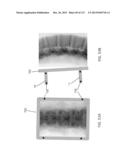 SURGICAL ROBOT PLATFORM diagram and image