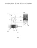 SURGICAL ROBOT PLATFORM diagram and image