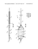 Method and System for Treating Valve Stenosis diagram and image