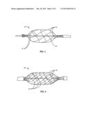 Method and System for Treating Valve Stenosis diagram and image