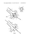 Method and System for Treating Valve Stenosis diagram and image