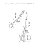 ULTRASONIC DEVICE FOR CUTTING AND COAGULATING diagram and image