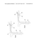 CLOT RETRIEVAL DEVICE FOR REMOVING OCCLUSIVE CLOT FROM A BLOOD VESSEL diagram and image