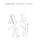 CLOT RETRIEVAL DEVICE FOR REMOVING OCCLUSIVE CLOT FROM A BLOOD VESSEL diagram and image